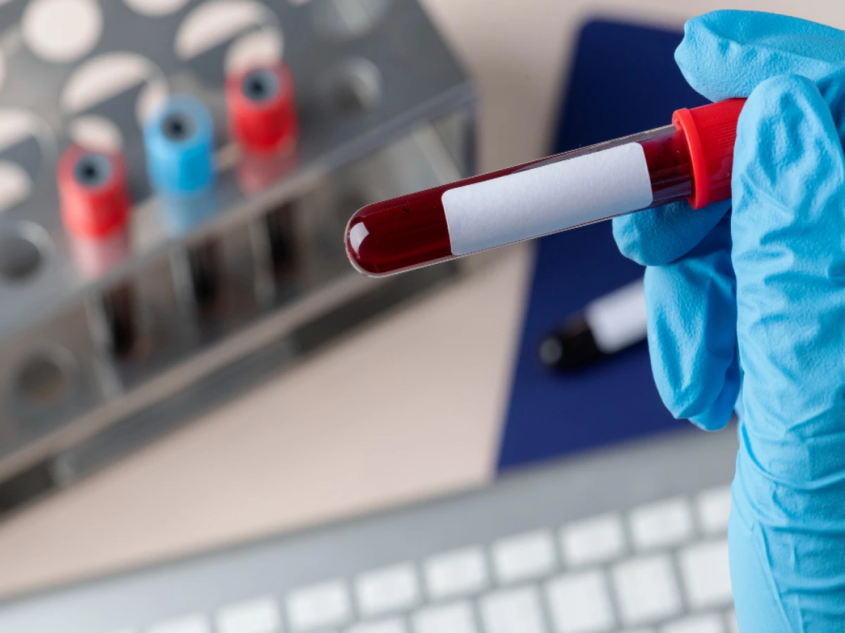 Curso de Hematologia Clínica e Hemoterapia